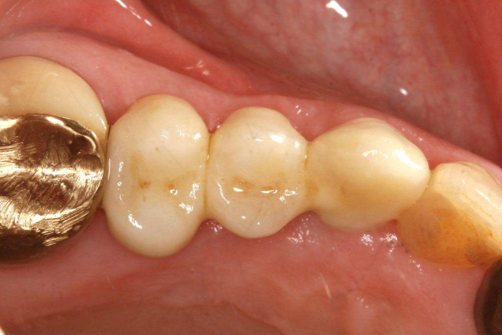 SonicWeld131 SonicWeld131