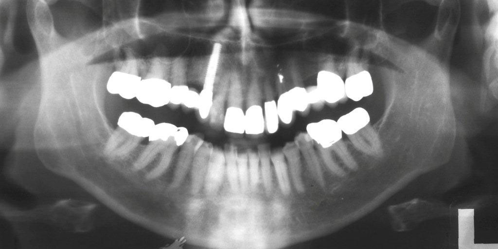 SonicWeld14 SonicWeld14
