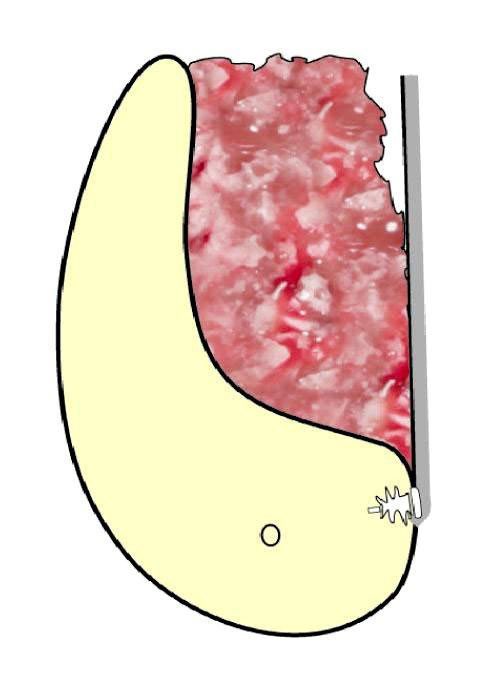 SonicWeld5 SonicWeld5