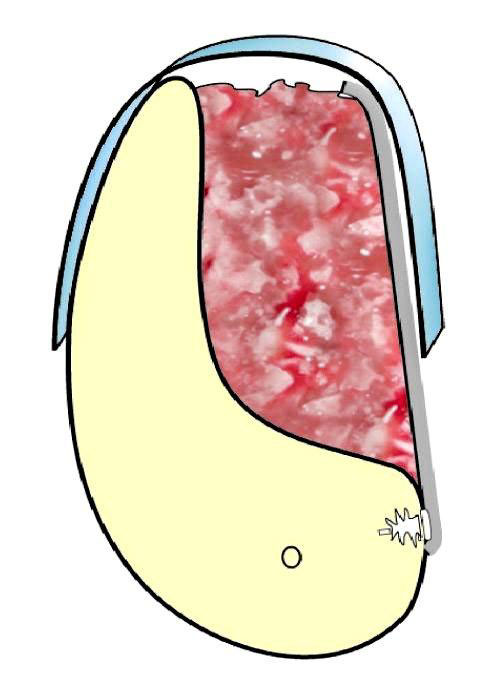 SonicWeld55