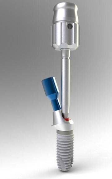 Bego_Abutments4.jpg Bego_Abutments4.jpg