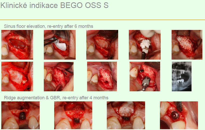 Bego Oss S Bego Oss S