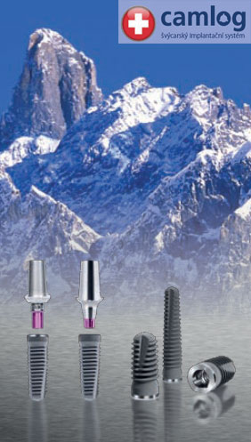 Camlog Implant