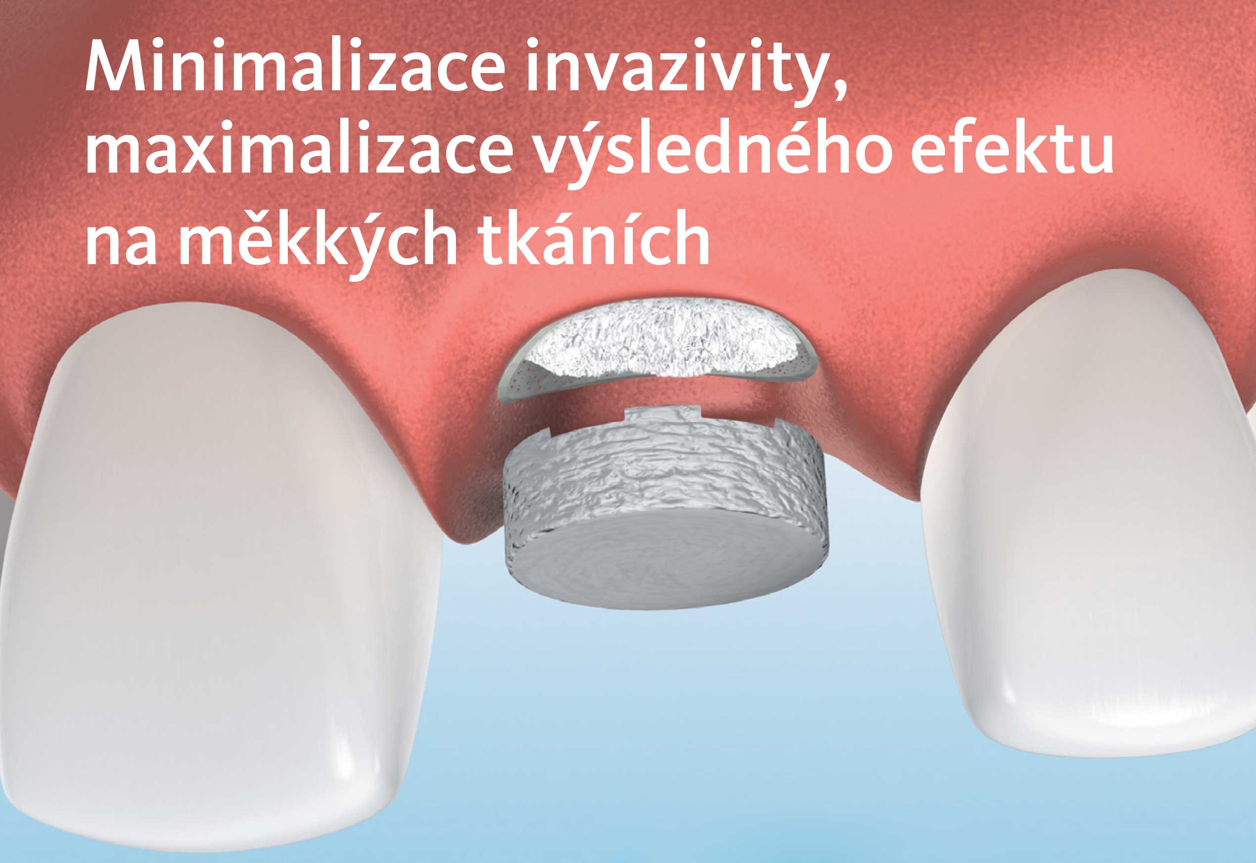 Geistlich Mucograft® Seal Geistlich Mucograft® Seal