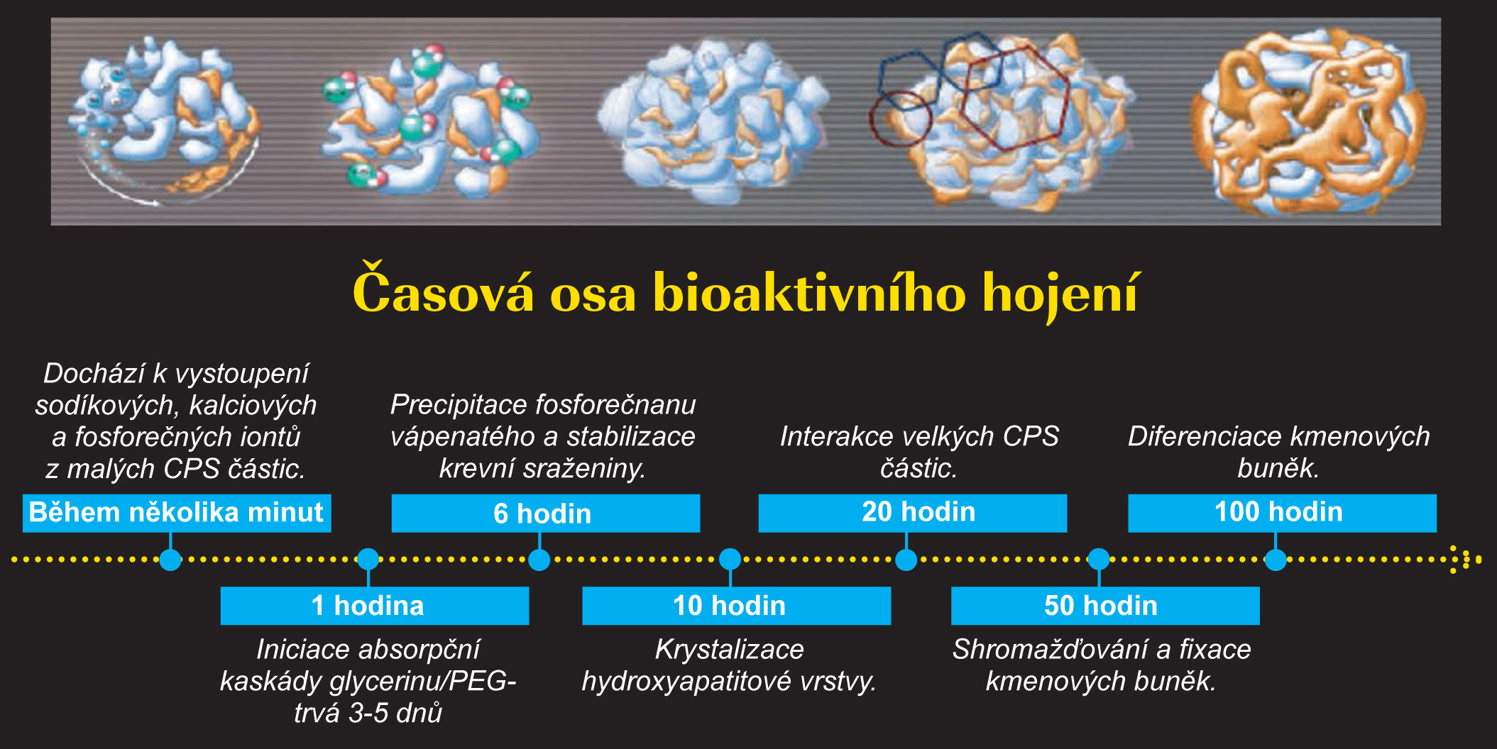 NovaBone2 NovaBone2