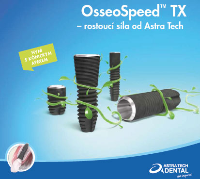 osseo_speed