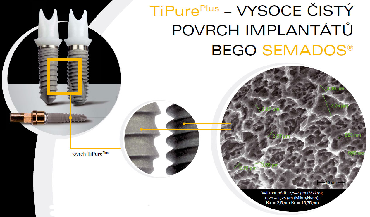 Semados_TiPure.jpg Semados_TiPure.jpg