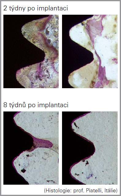 Semados_TiPure4.jpg
