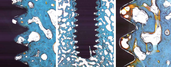 Semados_TiPure5.jpg Semados_TiPure5.jpg