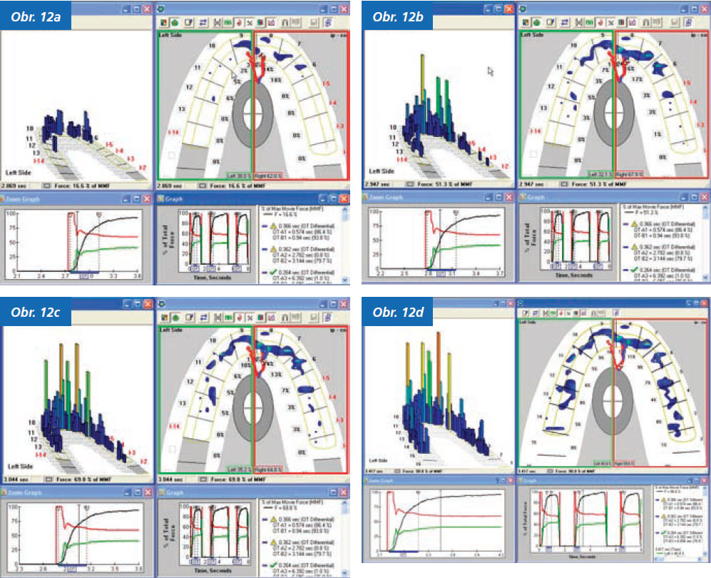 StomaTeam-2_2012_analyza_obr12abcd.jpg StomaTeam-2_2012_analyza_obr12abcd.jpg