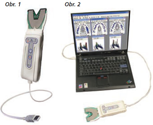 StomaTeam-2_2012_analyza_obr1_2.jpg StomaTeam-2_2012_analyza_obr1_2.jpg