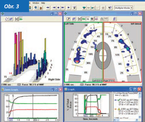StomaTeam-2_2012_analyza_obr3.jpg