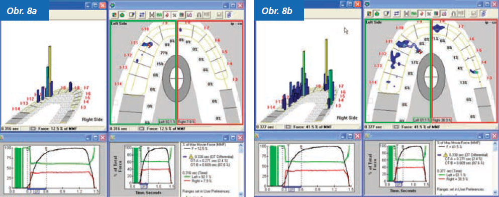 StomaTeam-2_2012_analyza_obr8ab.jpg