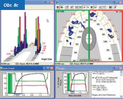 StomaTeam-2_2012_analyza_obr8c.jpg StomaTeam-2_2012_analyza_obr8c.jpg