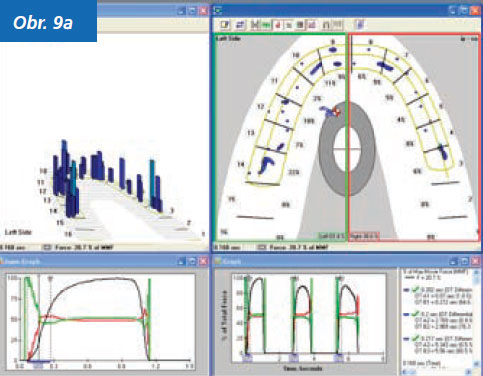 StomaTeam-2_2012_analyza_obr9a.jpg