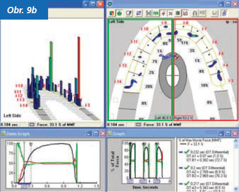 StomaTeam-2_2012_analyza_obr9b.jpg StomaTeam-2_2012_analyza_obr9b.jpg
