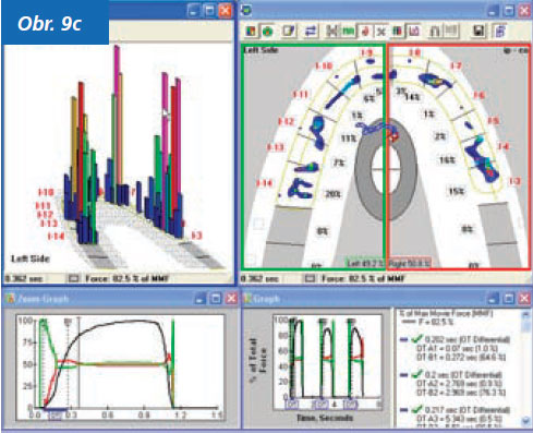 StomaTeam-2_2012_analyza_obr9c.jpg