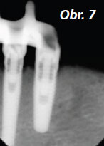 StomaTeam-2_2012_titan_obr7.jpg StomaTeam-2_2012_titan_obr7.jpg
