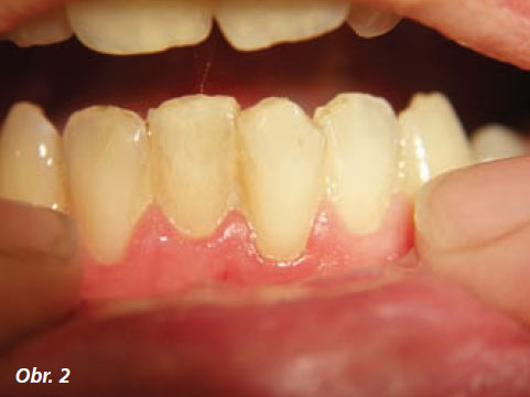 StomaTeam-5_2012_kurak_obr2.jpg