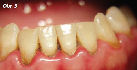 StomaTeam-5_2012_kurak_obr3.jpg