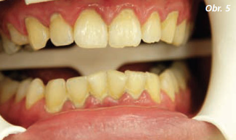 StomaTeam-5_2012_kurak_obr5.jpg