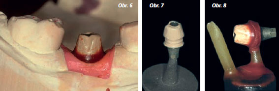 StomaTeam-6_2012_abutment_obr6_8.jpg StomaTeam-6_2012_abutment_obr6_8.jpg