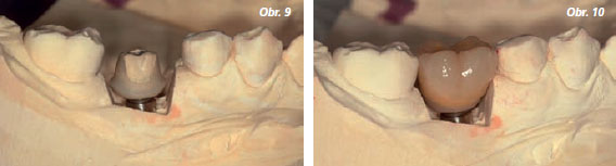 StomaTeam-6_2012_abutment_obr9_10.jpg StomaTeam-6_2012_abutment_obr9_10.jpg