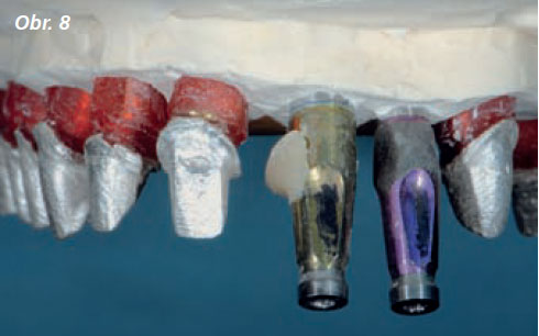StomaTeam-6_2012_estetika_obr8.jpg