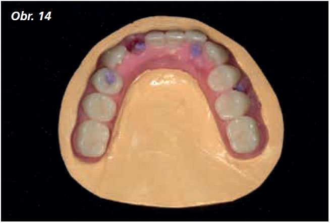 Osetreni_bezzube_abutment_5_13_12 Osetreni_bezzube_abutment_5_13_12