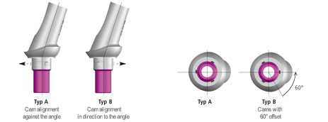 estomic_abutments_4 estomic_abutments_4