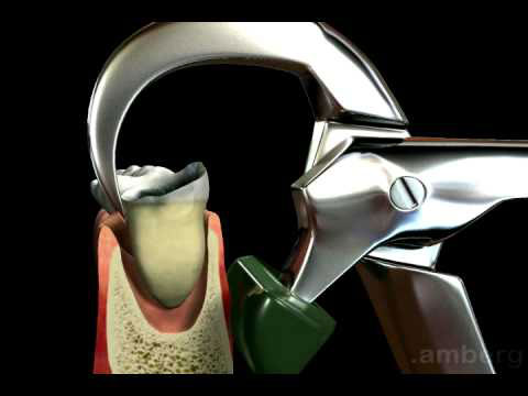 Physics Forceps Physics Forceps