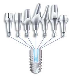 implants-ankylos2.jpg implants-ankylos2.jpg