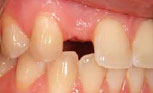 implants_Astra3.jpg implants_Astra3.jpg